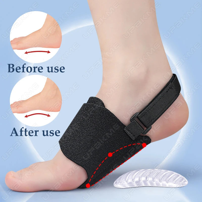 New Arch Support Foot Pad Orthopedic Insoles with Bandage Flat Feet Arch Shock Absorbing Talipes Valgus Correction for Leg Shape
